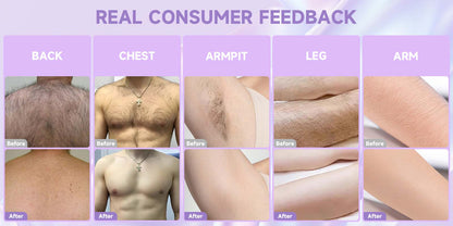 PHOFAY Bikini Pain-Free Hair Removal Cream for Sensitive Skin